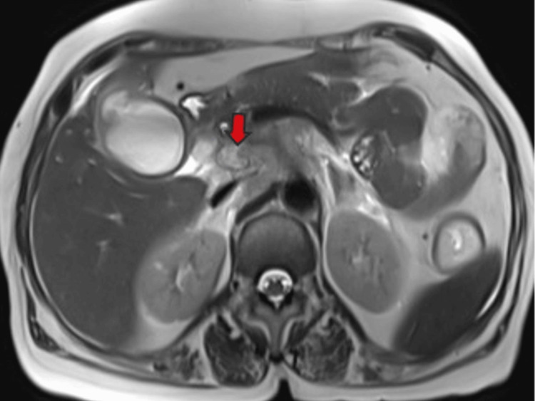 PMC11166205 – FIG11