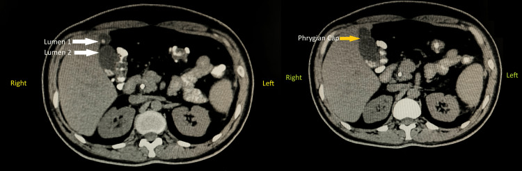 PMC11161672 – FIG2