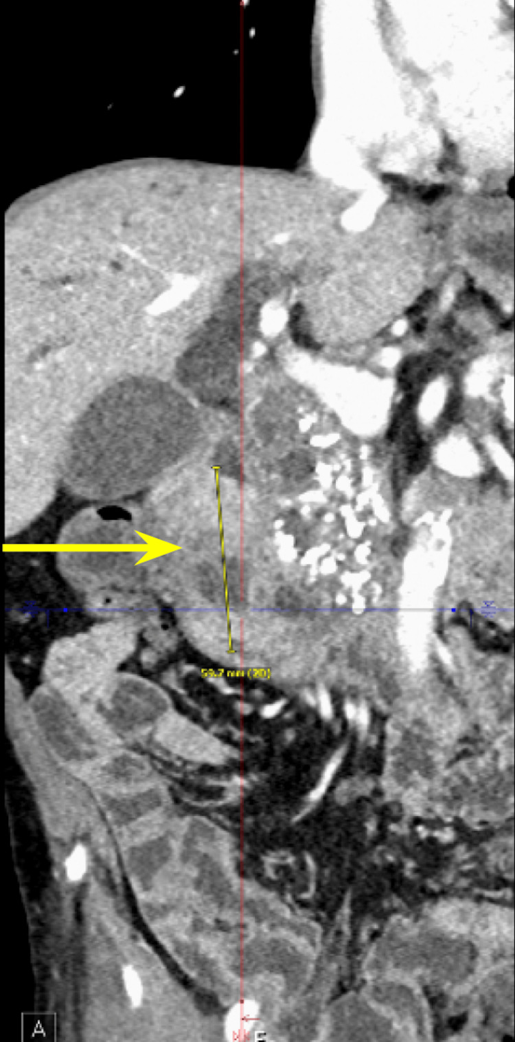 PMC11180534 – FIG2