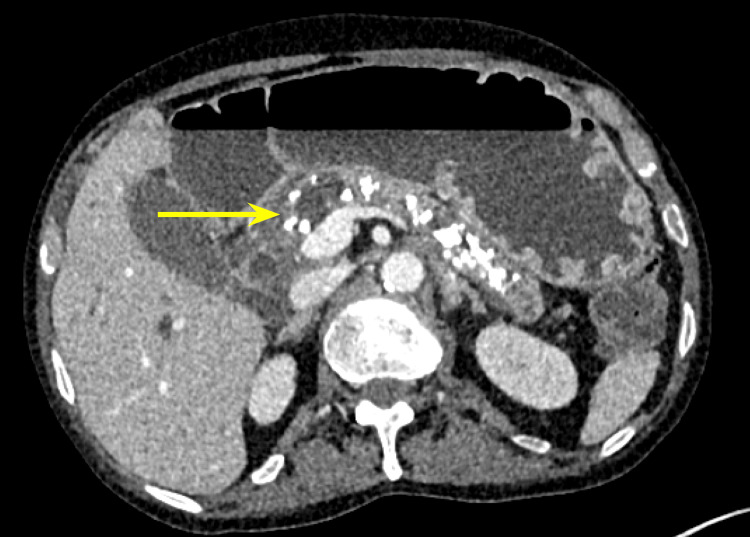 PMC11180534 – FIG3