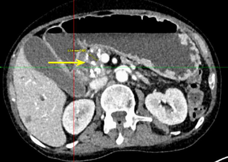 PMC11180534 – FIG4