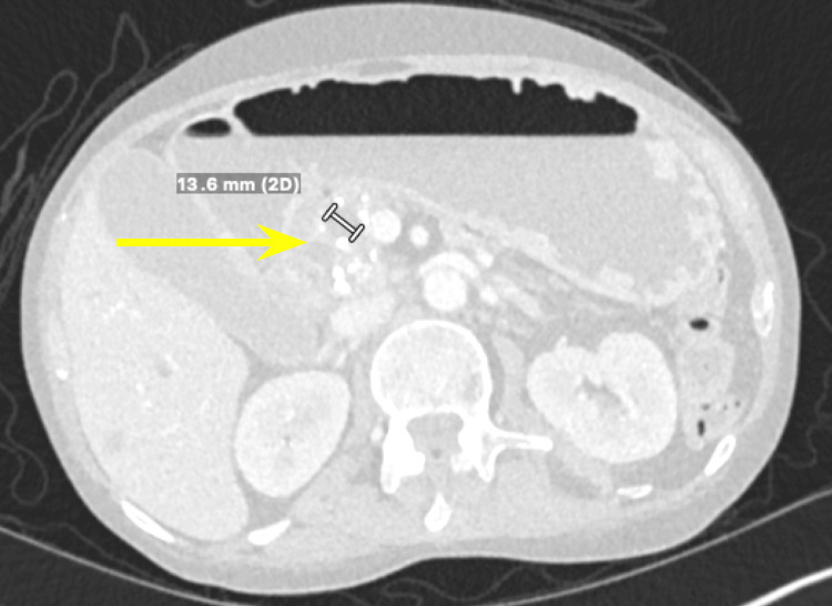 PMC11180534 – FIG5