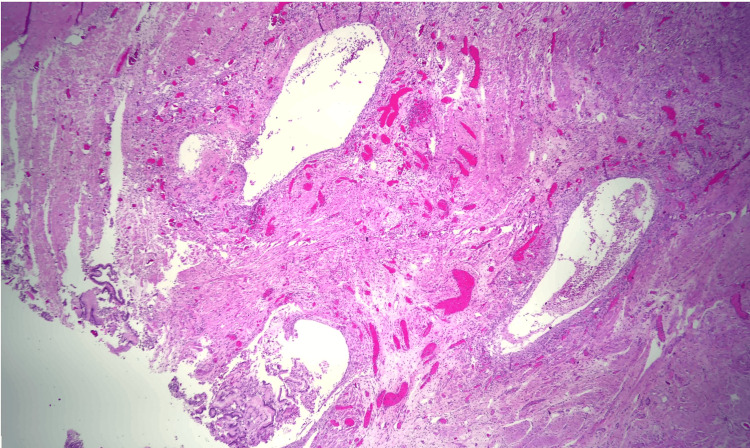 PMC11180534 – FIG6