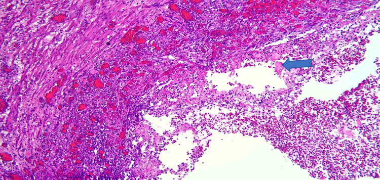 PMC11180534 – FIG7