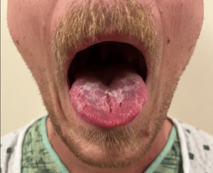 PMC11187777 – FIG1