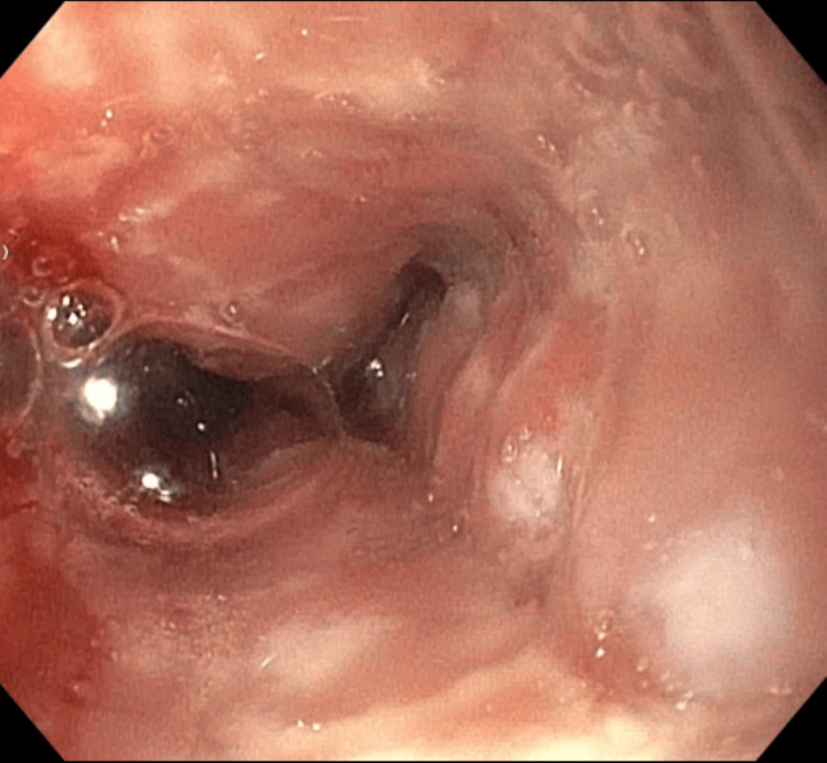 PMC11187777 – FIG2