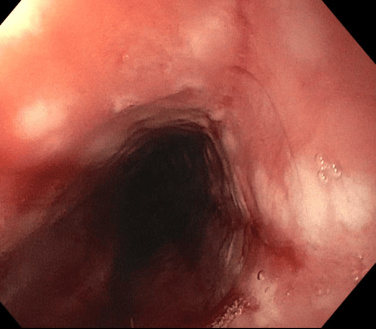 PMC11187777 – FIG3