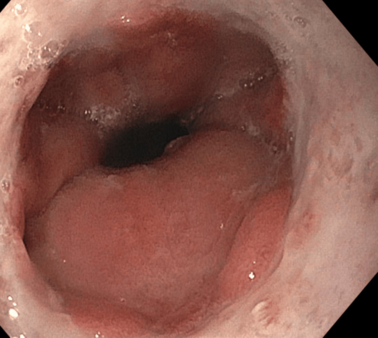 PMC11187777 – FIG4