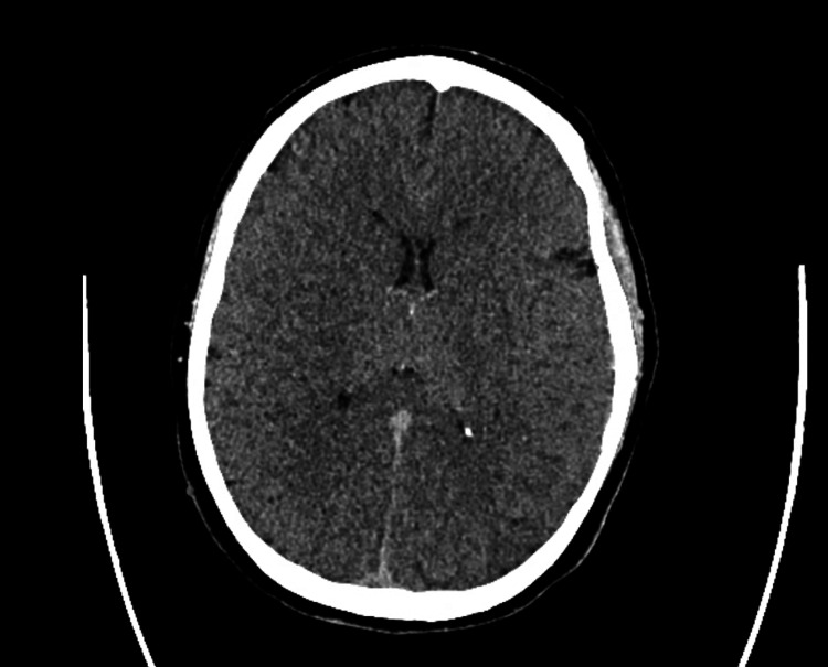 PMC11297651 – FIG2