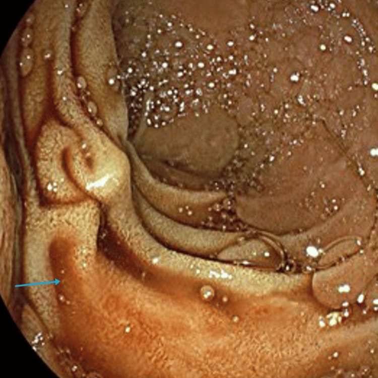 PMC11309757 – FIG4