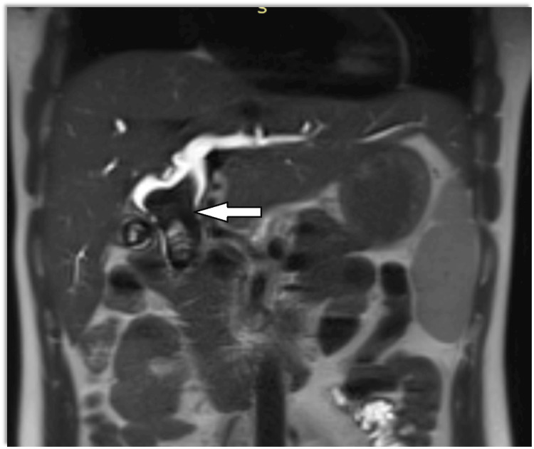 PMC11316851 – FIG1