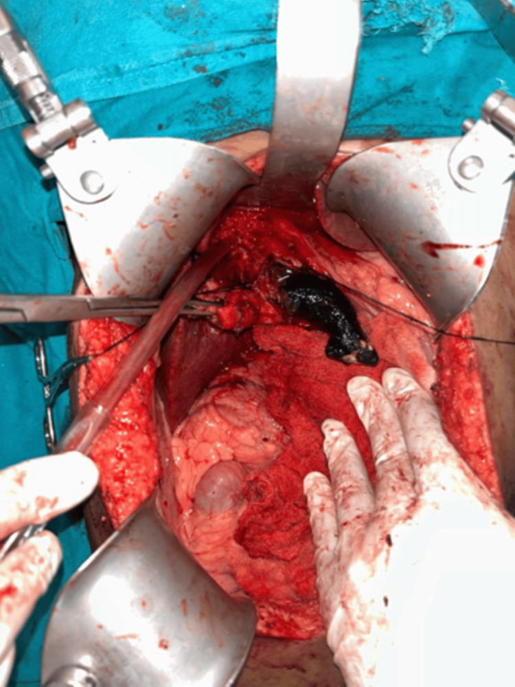 PMC11316851 – FIG4