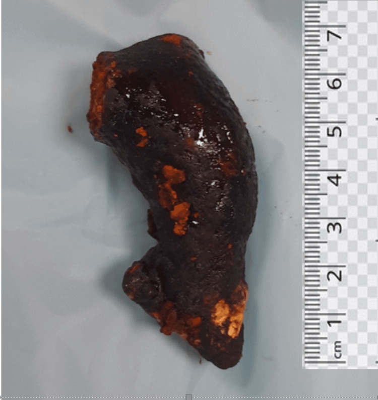 PMC11316851 – FIG5