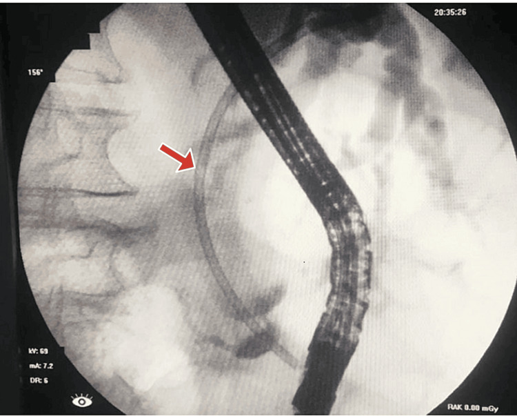 PMC11325256 – FIG2