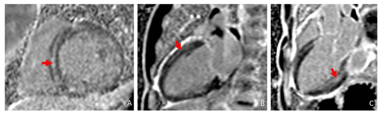 PMC11404528 – FIG3
