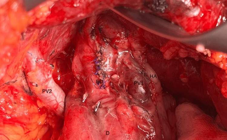 PMC11456693 – FIG4