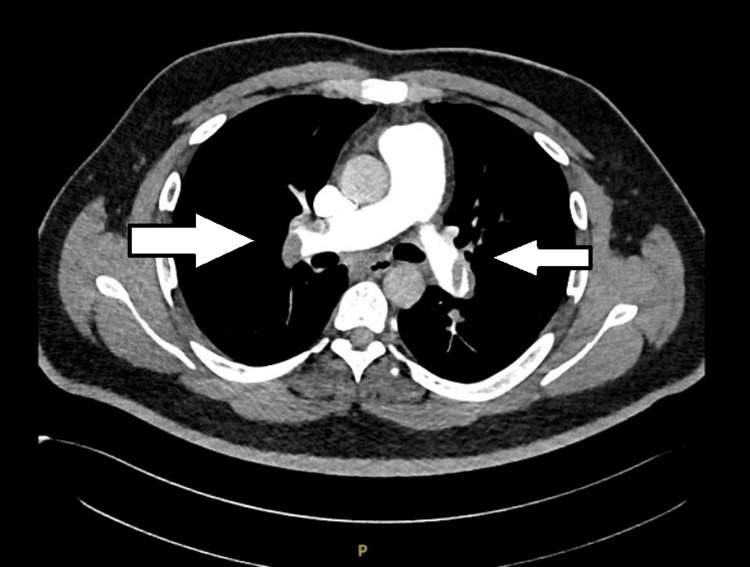 PMC11491558 – FIG2