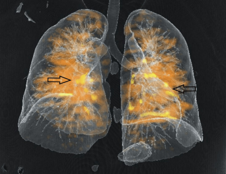 PMC11491558 – FIG3