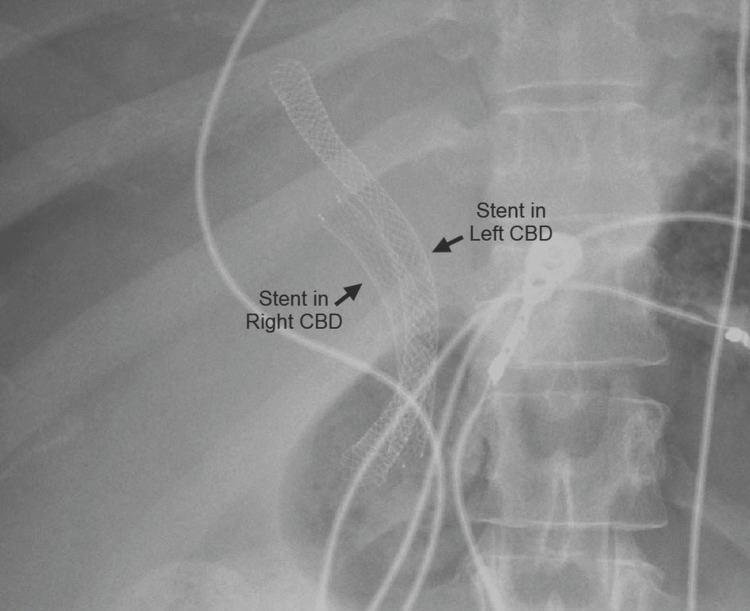PMC11501856 – FIG5