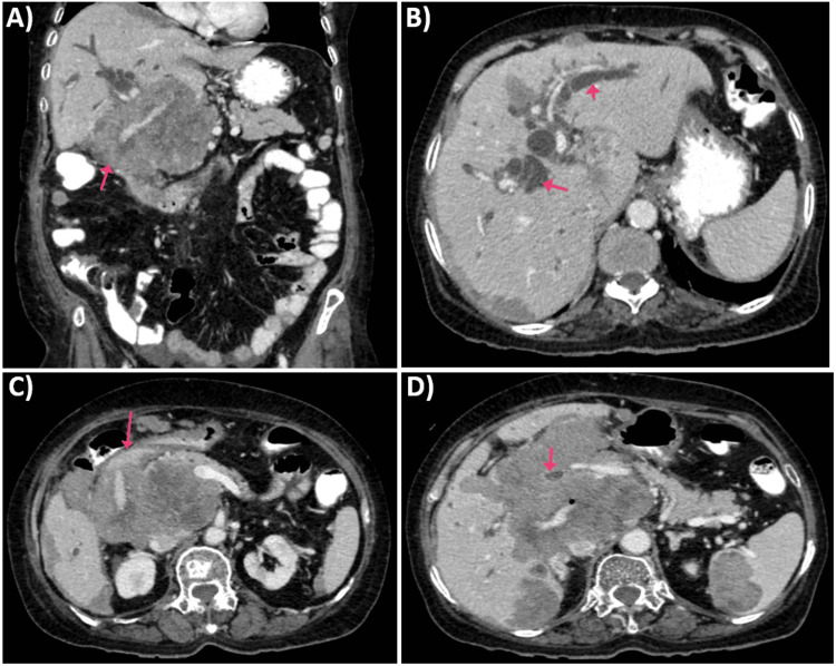 PMC11554442 – FIG1