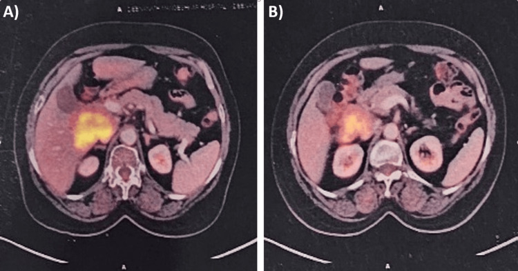 PMC11554442 – FIG2