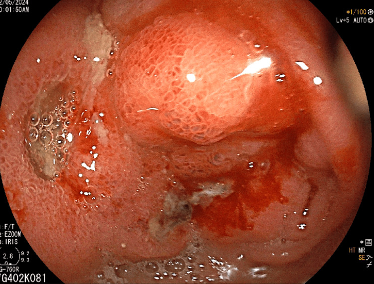 PMC11554442 – FIG3