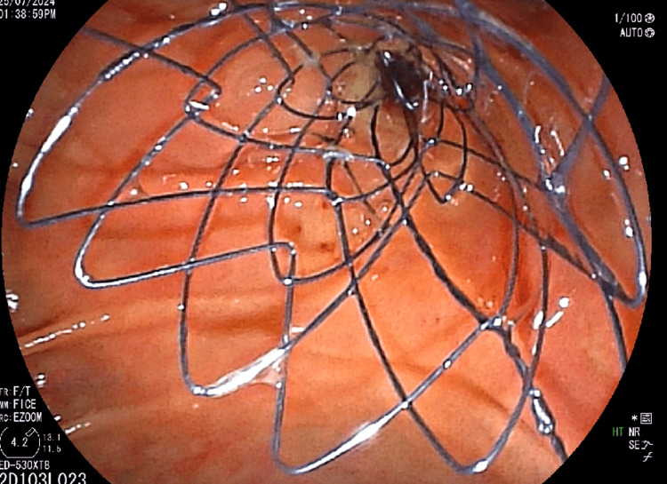 PMC11554442 – FIG4