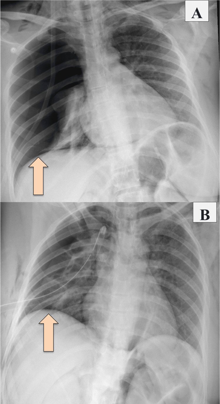 PMC11558017 – FIG1