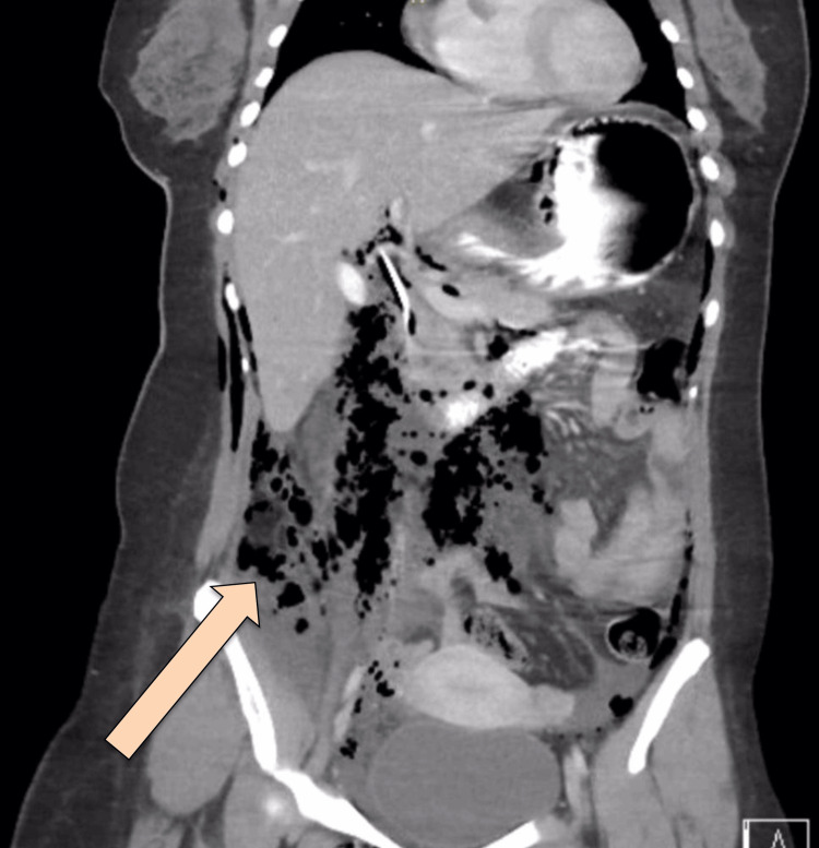 PMC11558017 – FIG2