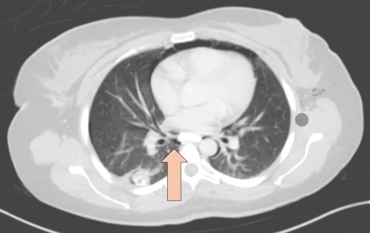 PMC11558017 – FIG4