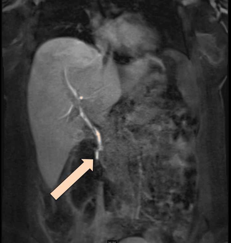 PMC11558017 – FIG5
