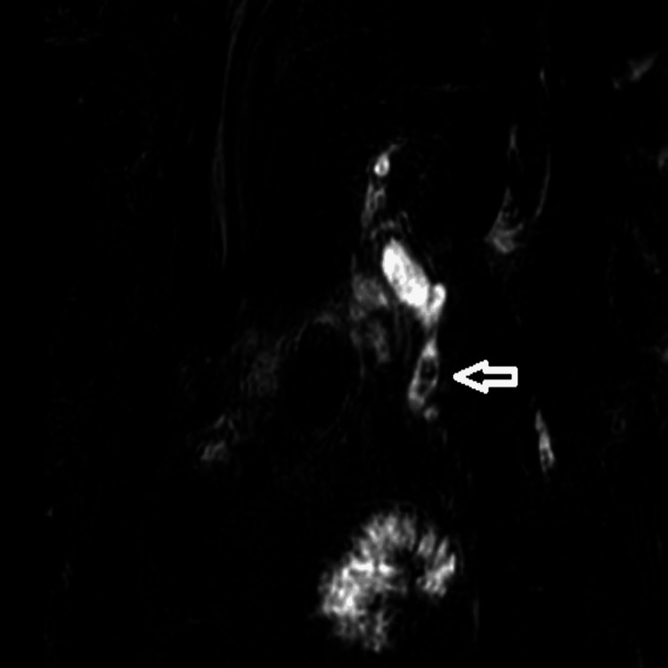 PMC11566346 – FIG1