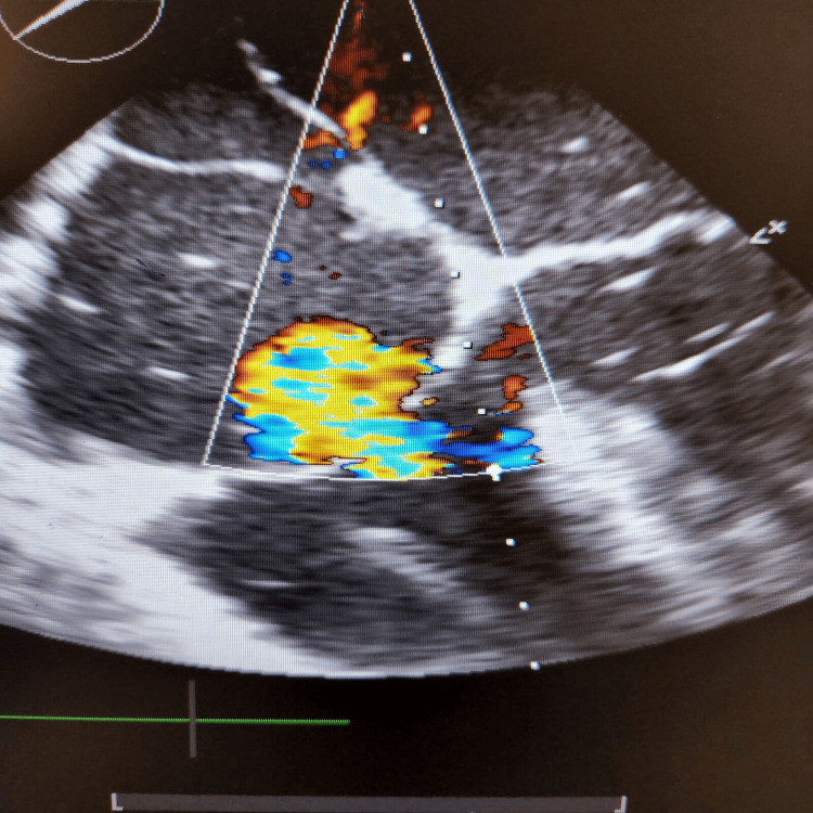 PMC11566346 – FIG2