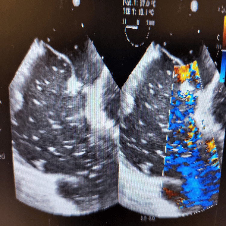 PMC11566346 – FIG4