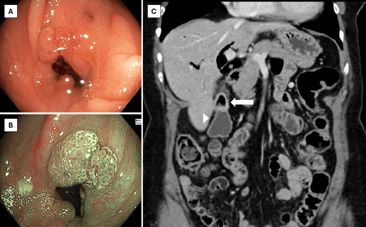 PMC11623043 – FIG1