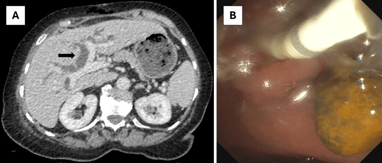 PMC11623043 – FIG2