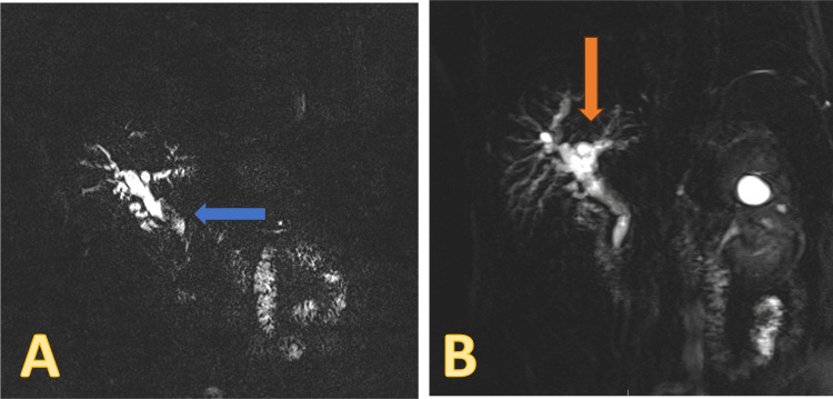 PMC11780476 – FIG1