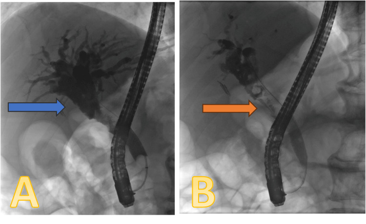 PMC11780476 – FIG2