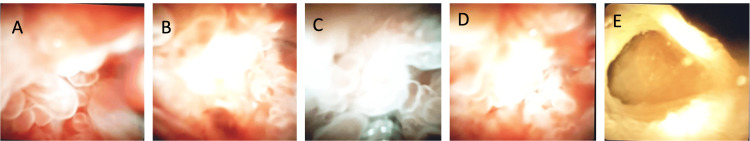 PMC11780476 – FIG3