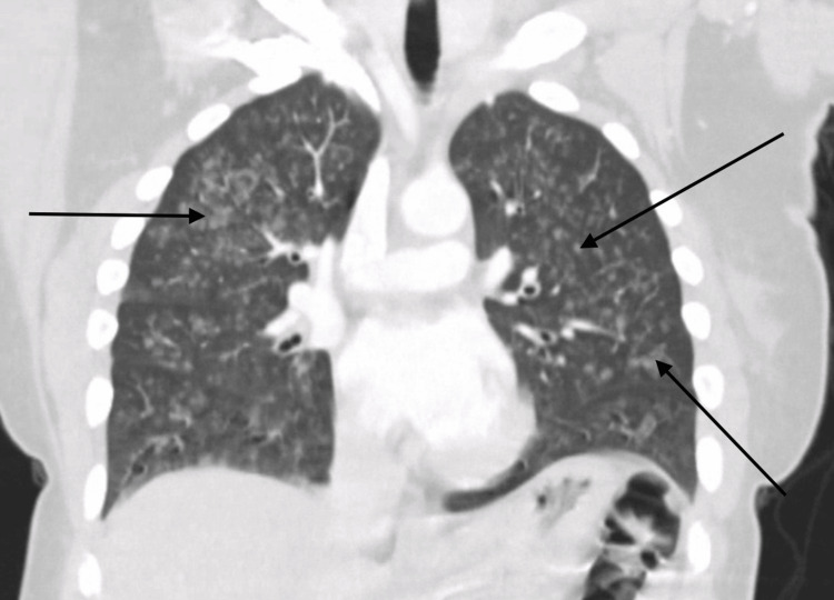 PMC11785422 – FIG2