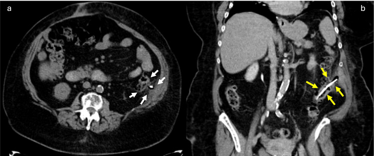 PMC11913399 – FIG1