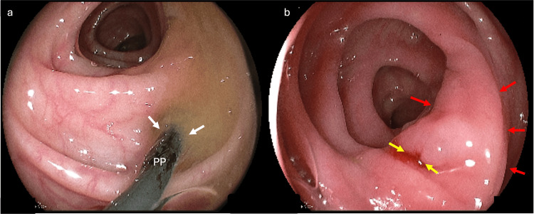 PMC11913399 – FIG2