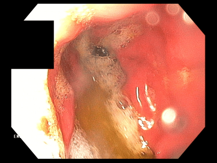 PMC11959201 – FIG3