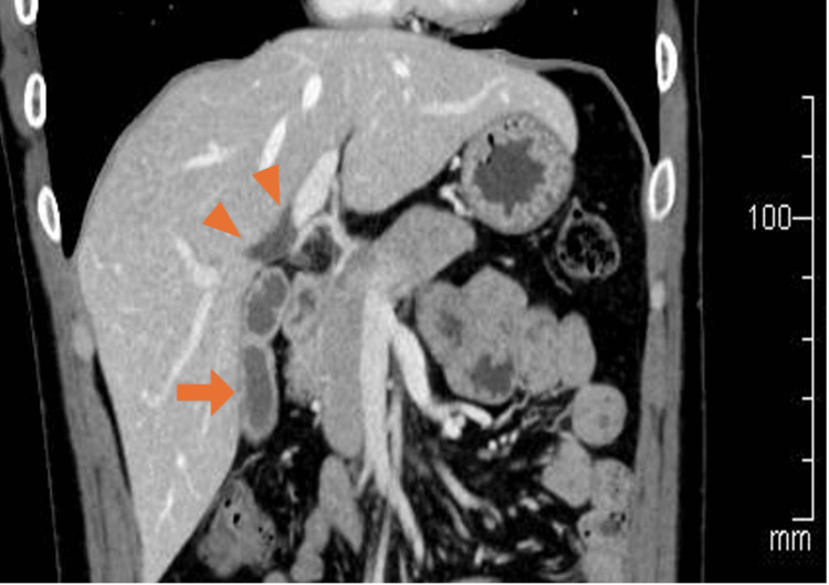 PMC11970871 – FIG1