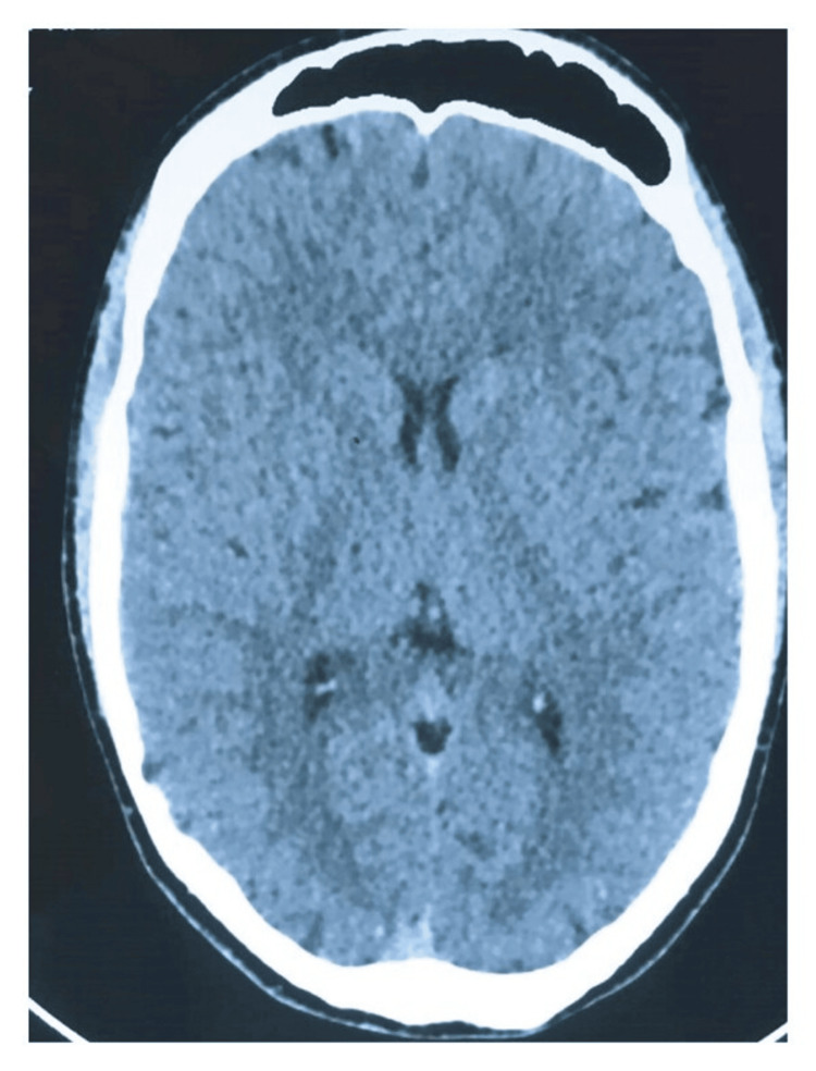 PMC11981236 – FIG1