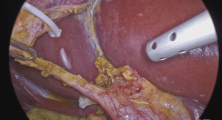 PMC11986274 – FIG1