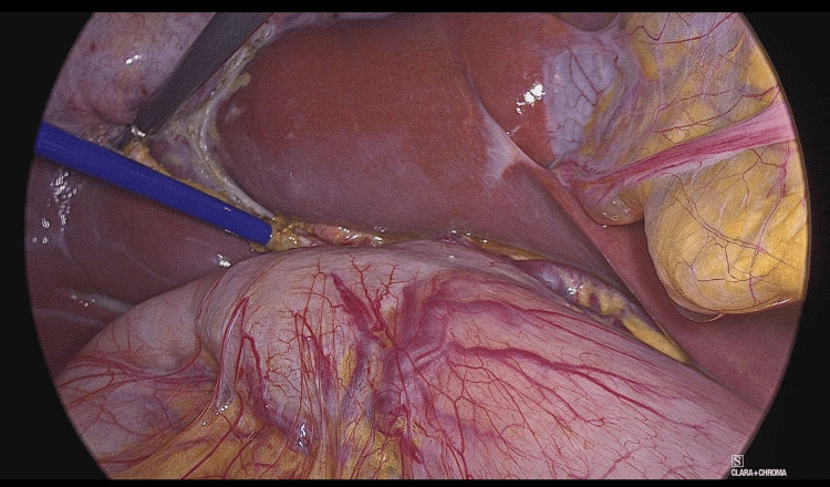 PMC11986274 – FIG3