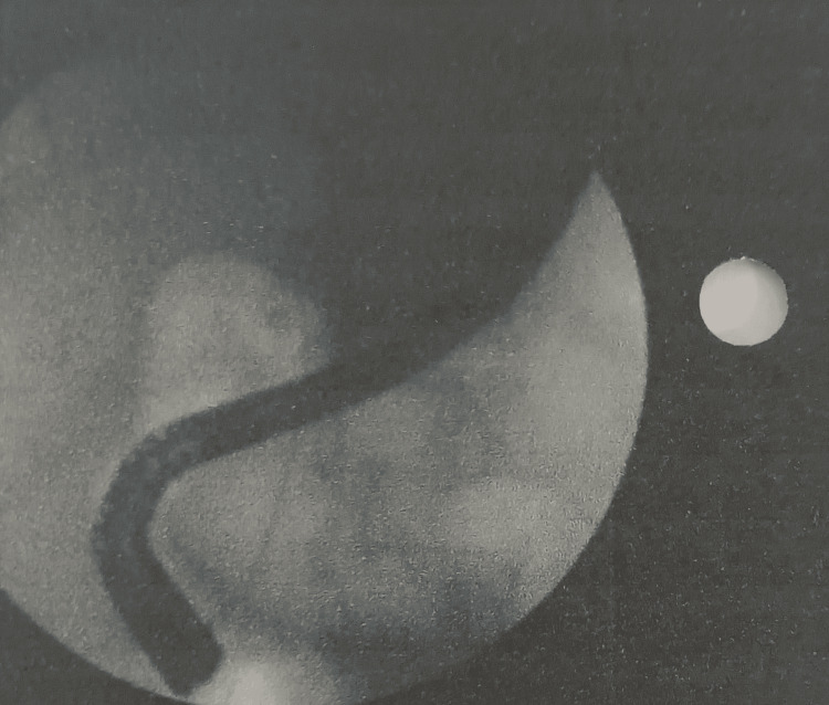 PMC12006735 – FIG1