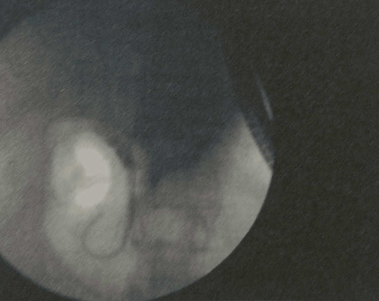 PMC12006735 – FIG2