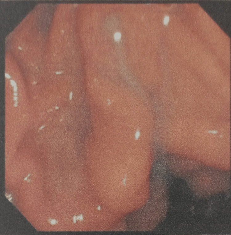 PMC12006735 – FIG3